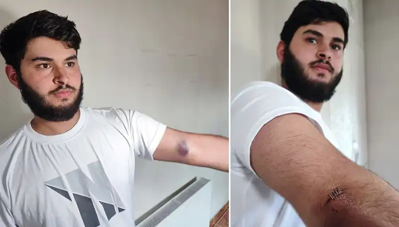 Bahçeye Kaçan Topun Ardındaki Gizemli Olay: Conolar Kamyonetle Geldi!