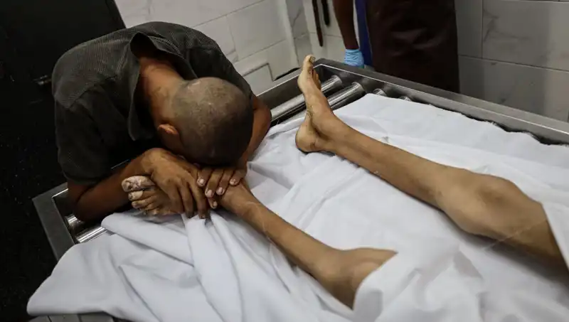 Gazze'de Açlık Bilançosu: Bir Çocuk Daha Hayatını Kaybetti